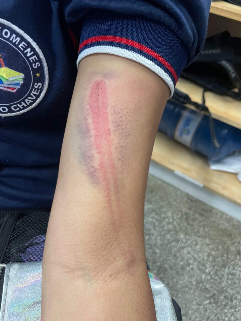 Adolescente de 12 anos é espancada pela mãe e padrasto no bairro Jorge Teixeira