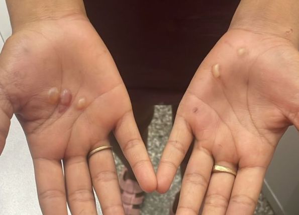 Polícia Civil do Amazonas prende mulher por torturar adolescente de 12 anos com queimaduras e socos em Manaus