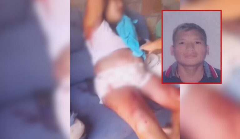 Homem agride esposa grávida com facadas e foge em Manaus