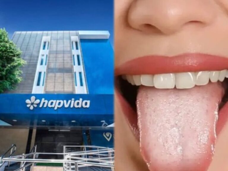 Hapvida alerta: língua branca pode indicar problemas de saúde e exige atenção na higiene bucal