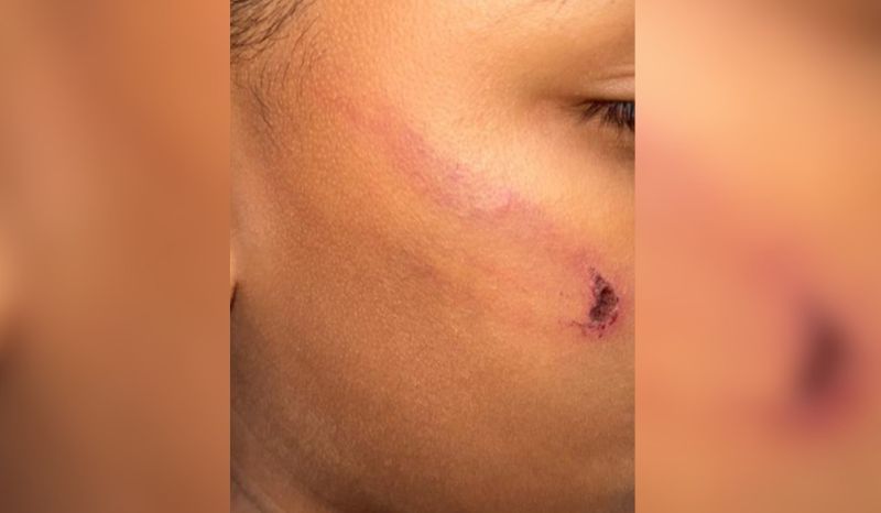 Criança perde dente após ser agredida pela mãe com corda no interior do Amazonas